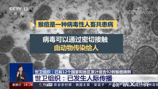 猴痘病毒中國有嗎？感染會出現(xiàn)什么癥狀？